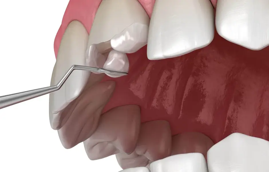 Cosmetic Dentistry