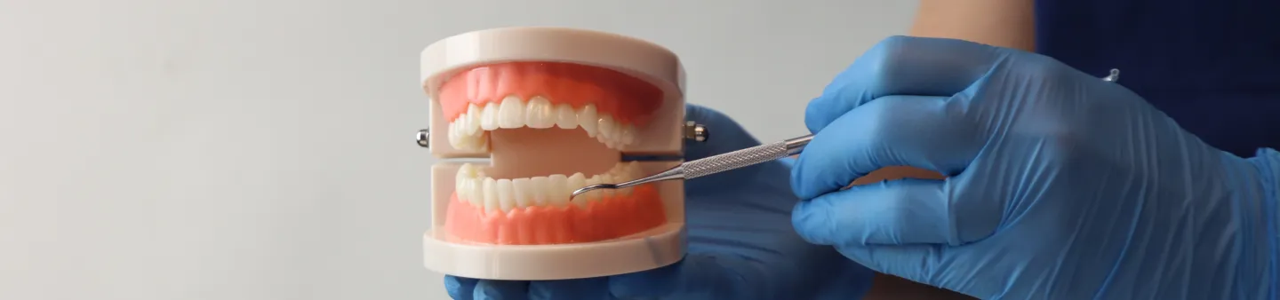 Implant-Supported Dentures